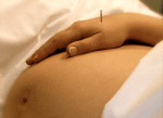 Acupuncture and Pregnancy